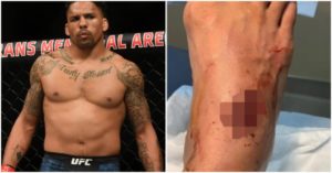 UFC bojovník Eryk Anders vs motorová píla - hrozná nehoda (FOTO)