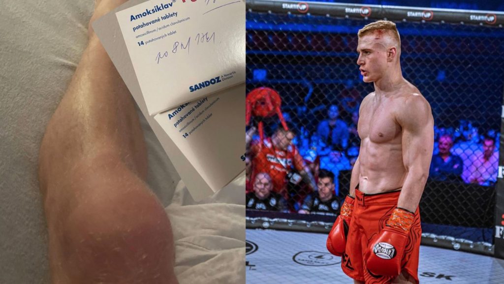 Leo Brichta zápasil v Budapešti pod antibiotikami! Čaká ho teraz ešte väčšia výzva?