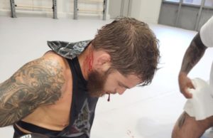 FOTO: Tomáš Deák utrpel nepríjemné zranenie a musel zrušiť svoj blížiaci sa zápas