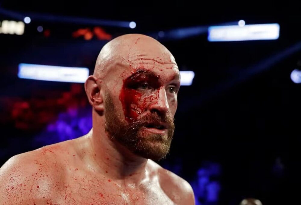 To hádam nie. Veľkolepý boxerský zápas Tyson Fury vs Oleksandr Usyk má byť zrušený z tohto dôvodu!