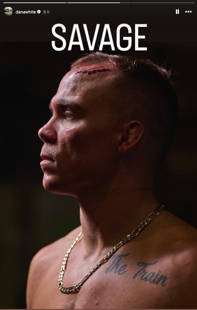 VIDEO: Dana White zdieľal nechutnú tržnú ranu Landwehra po jeho víťazstve na UFC Fight Night