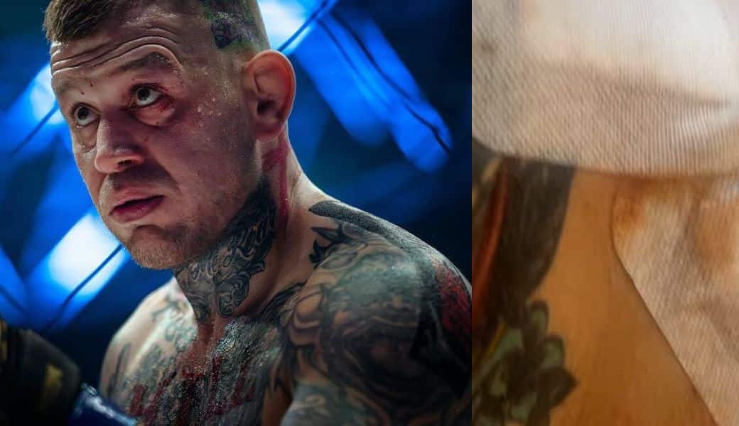 VIDEO Masaker! Vašek Mikulášek má za sebou veľmi nepríjemnú skúsenosť. Je ohrozený jeho blížiaci sa zápas?